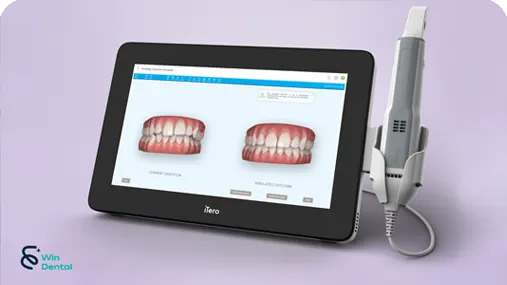 Cong nghe May iTero Element 5D Plus V1