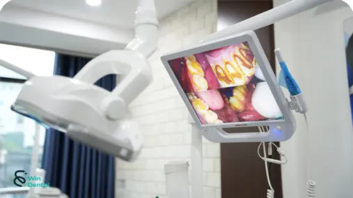 Cong nghe May soi khoang mieng Osaka dent V1