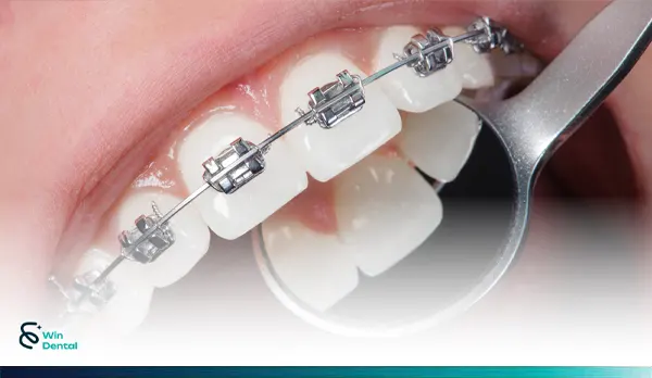 Nieng Rang Nieng rang mac cai