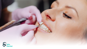 Răng sứ thẩm mỹ – Giải pháp kiến tạo nụ cười tự nhiên