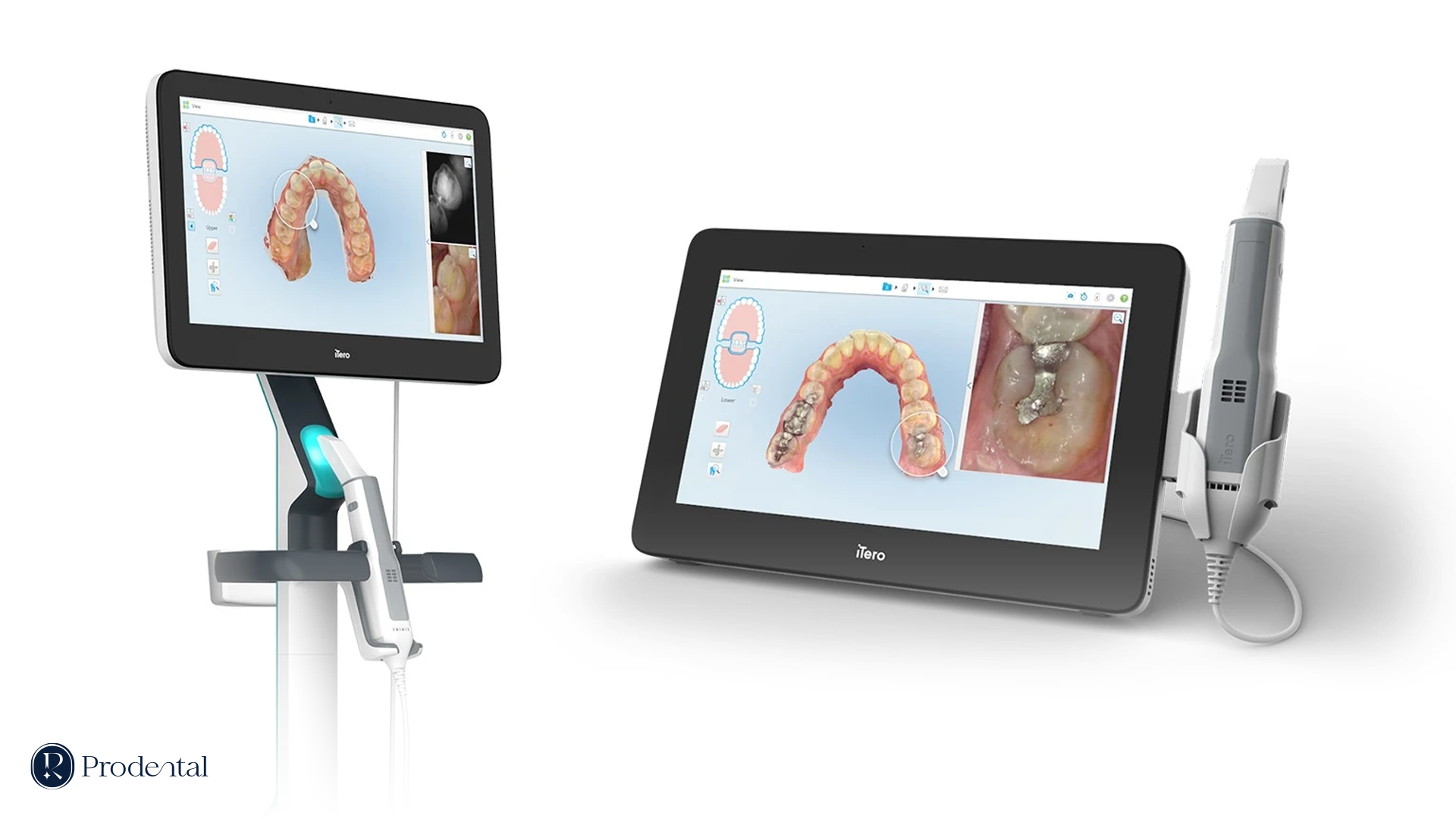 Trang chủ 19 ITERO 5D