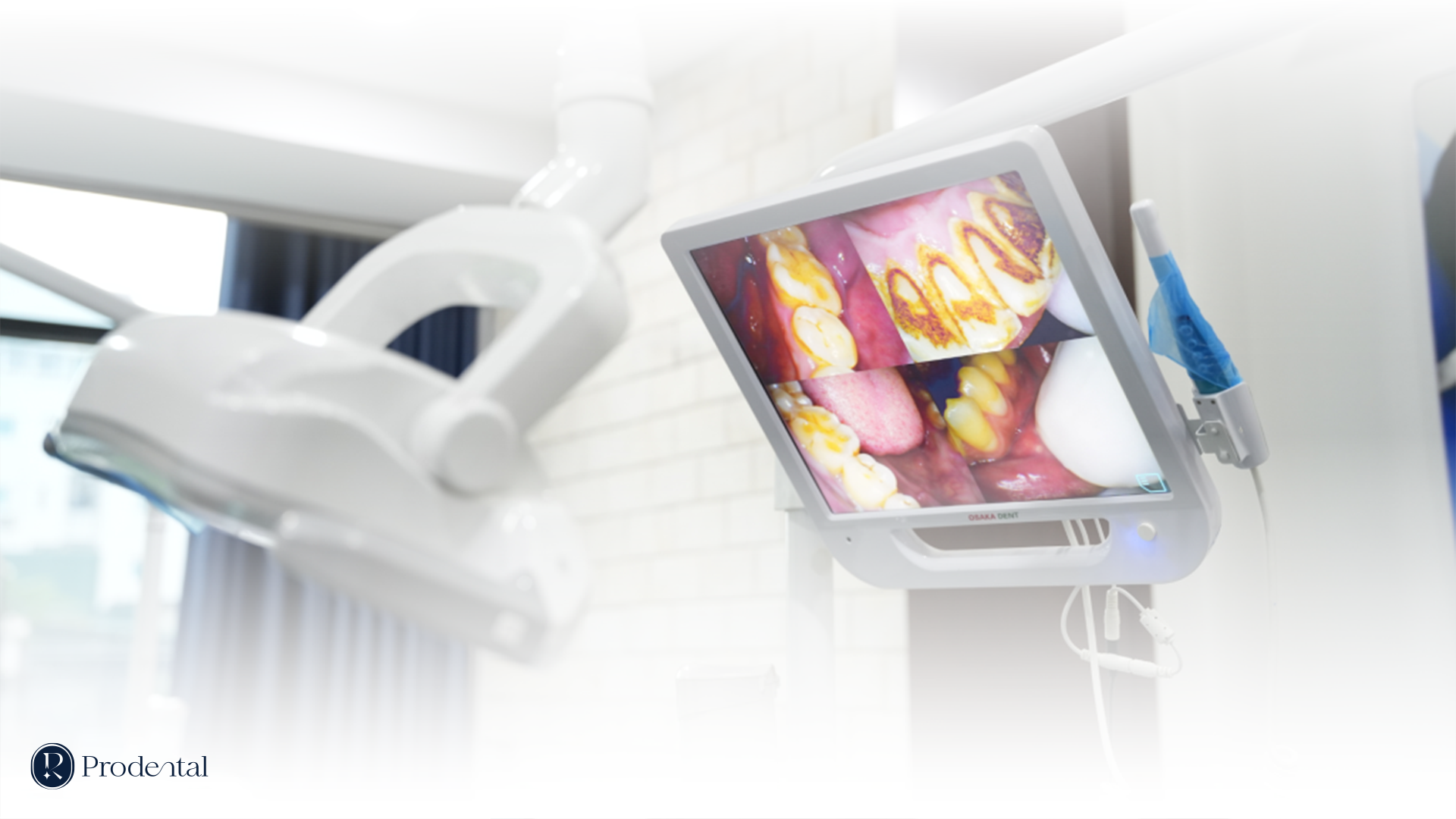 Trang chủ 23 MAY SOI KHOANG MIENG