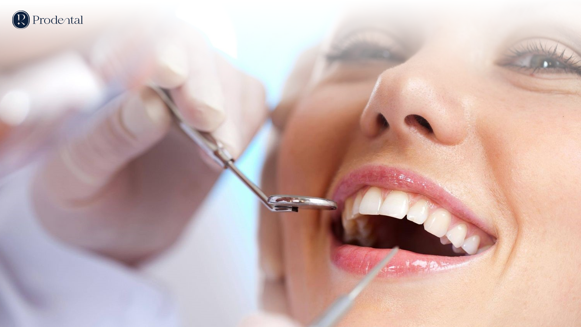 Bọc chụp răng sứ 3 RANG SU 2