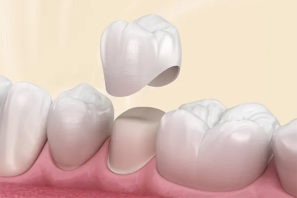 Trang chủ 13 Rang su Pro