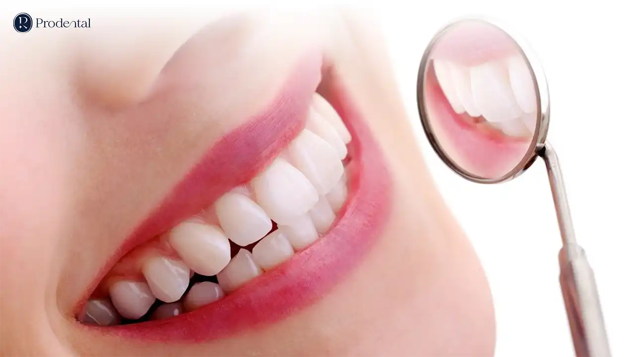 Răng sứ thẩm mỹ 7 Rang su tham my Pro 0