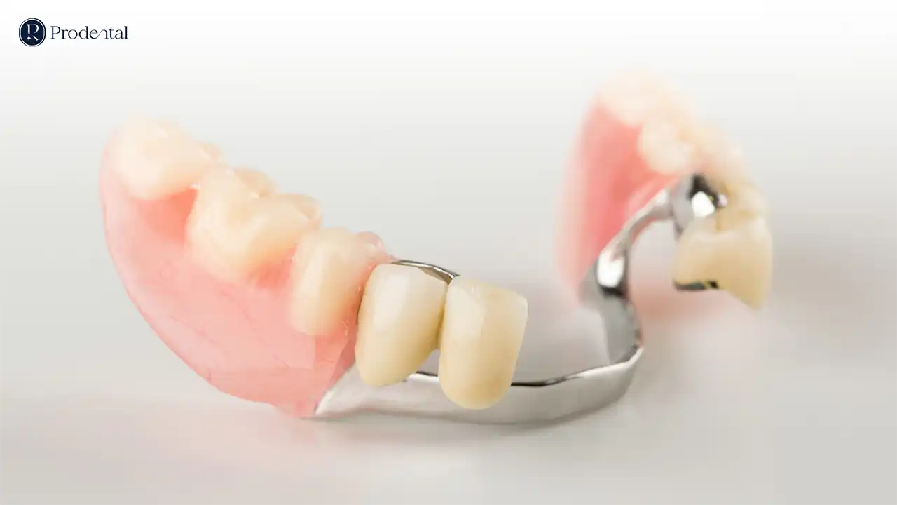 Hàm tháo lắp 5 ham thao lap Pro 3