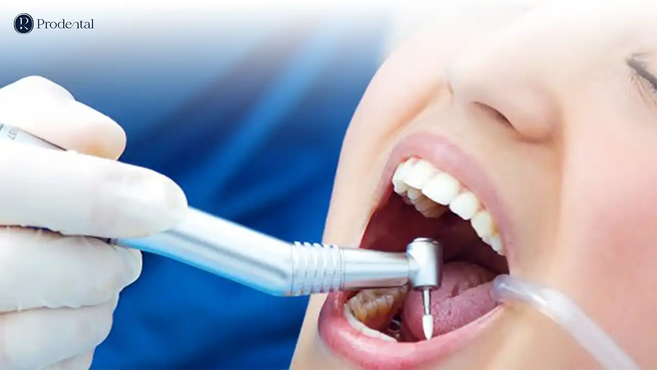 Nha khoa tổng quát 5 Nha khoa tổng quát